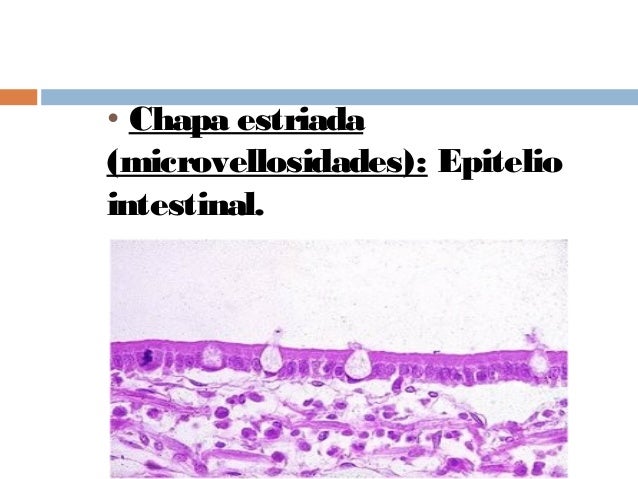 Clase de tejido epitelial