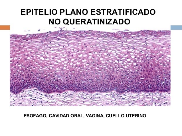 Clase de tejido epitelial