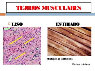TEJIDOS MUSCULARES
 LISO ESTRIADO
Varios núcleos
Miofibrillas estriadas
 