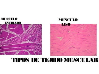 TIPOS DE TEJIDO MUSCULAR
MUSCULO
ESTRIADO
MUSCULO
LISO
 