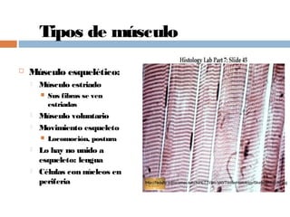 Tipos de músculo
 Músculo esquelético:
 Músculo estriado
 Sus fibras se ven
estriadas
 Músculo voluntario
 Movimiento esqueleto
 Locomoción, postura
 Lo hay no unido a
esqueleto: lengua
 Células con núcleos en
periferia http://faculty.sdmiramar.edu/KPETTI/Bio160/TissueHistology/SkeletalMuscle.jpg
 