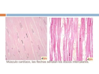 Músculo cardíaco, las flechas señalan los discos intercalares.
 