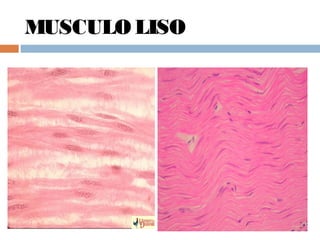 MUSCULO LISO
 