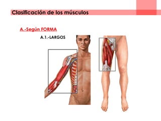 A.-Según FORMA
A.1.-LARGOS
Clasificación de los músculos
 