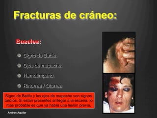 Fracturas de cráneo:
!   Signo de Battle.
!   Ojos de mapache.
!   Hemotimpano.
!   Rinorrea / Otorrea
Andres Aguilar
Basales:
Signo de Battle y los ojos de mapache son signos
tardíos. Si estan presentes al llegar a la escena, lo
mas probable es que ya había una lesión previa.
 