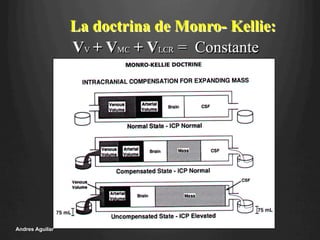 La doctrina de Monro- Kellie:
VV + VMC + VLCR = Constante
Andres Aguilar
 