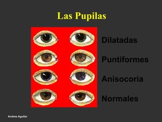 Las Pupilas
Dilatadas
Puntiformes
Anisocoria
Normales
Andres Aguilar
 