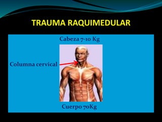 TRAUMA RAQUIMEDULAR 
Cabeza 7-10 Kg 
Columna cervical 
Cuerpo 70Kg 
 