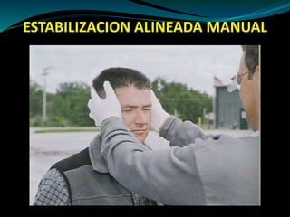 ESTABILIZACION ALINEADA MANUAL 
 