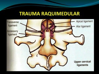 TRAUMA RAQUIMEDULAR 
 