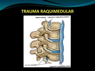 TRAUMA RAQUIMEDULAR 
 