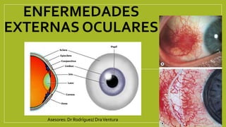 ENFERMEDADES
EXTERNAS OCULARES
Asesores: Dr Rodríguez/ DraVentura
 