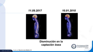 Creado por Mauricio Lema Medina MD
10.01.201811.09.2017
Disminución en la
captación ósea
 