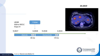 Creado por Mauricio Lema Medina MD
L858R
Adeno NSCLC
Etapa IV
Afatinib
T790M
9.2017 6.2018
PD
+8 mo
Afatinib Osimertinib
T790M
9.2017 6.2018 9.2018 3.2019
PD PD
+8 mo +9 mo
03.2019
 