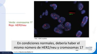 Creado por Mauricio Lema Medina MD
Verde: cromosoma 17
Rojo: HER2/neu
En condiciones normales, debería haber el
mismo número de HER2/neu y cromosomas 17
 