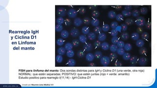 Creado por Mauricio Lema Medina MD
Rearreglo IgH
y Ciclina D1
en Linfoma
del manto
FISH para linfoma del manto: Dos sondas distintas para IgH y Ciclina D1 (una verde, otra roja)
NORMAL: que estén separadas; POSITIVO: que estén juntas (rojo + verde: amarillo)
Estudio positivo para rearreglo t(11;14) - IgH-Ciclina D1
 