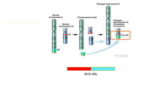 BCR-ABL
 
