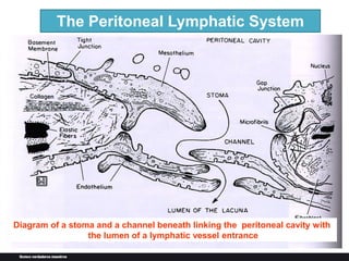 The Peritoneal Lymphatic System
Diagram of a stoma and a channel beneath linking the peritoneal cavity with
the lumen of a lymphatic vessel entrance
 