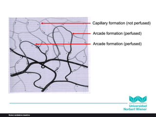 Peritoneal Microvasculature
Arcade formation (perfused)
Arcade formation (perfused)
Capillary formation (not perfused)
 
