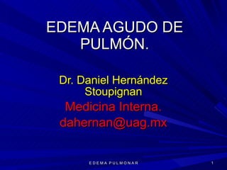 EDEMA AGUDO DE PULMÓN. Dr. Daniel Hernández Stoupignan Medicina Interna. [email_address] E D E M A  P U L M O N A R 
