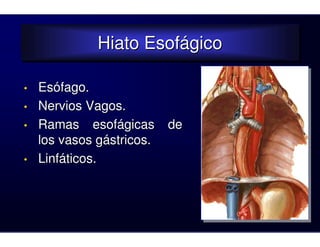 Hiato Esofágico
              Hiato Esofágico

•   Esófago.
•   Nervios Vagos.
•   Ramas esofágicas       de
    los vasos gástricos.
•   Linfáticos.
 