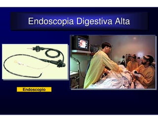 Endoscopia Digestiva Alta
  Endoscopia Digestiva Alta




Endoscopio
 