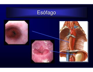 Esófago
Esófago
 