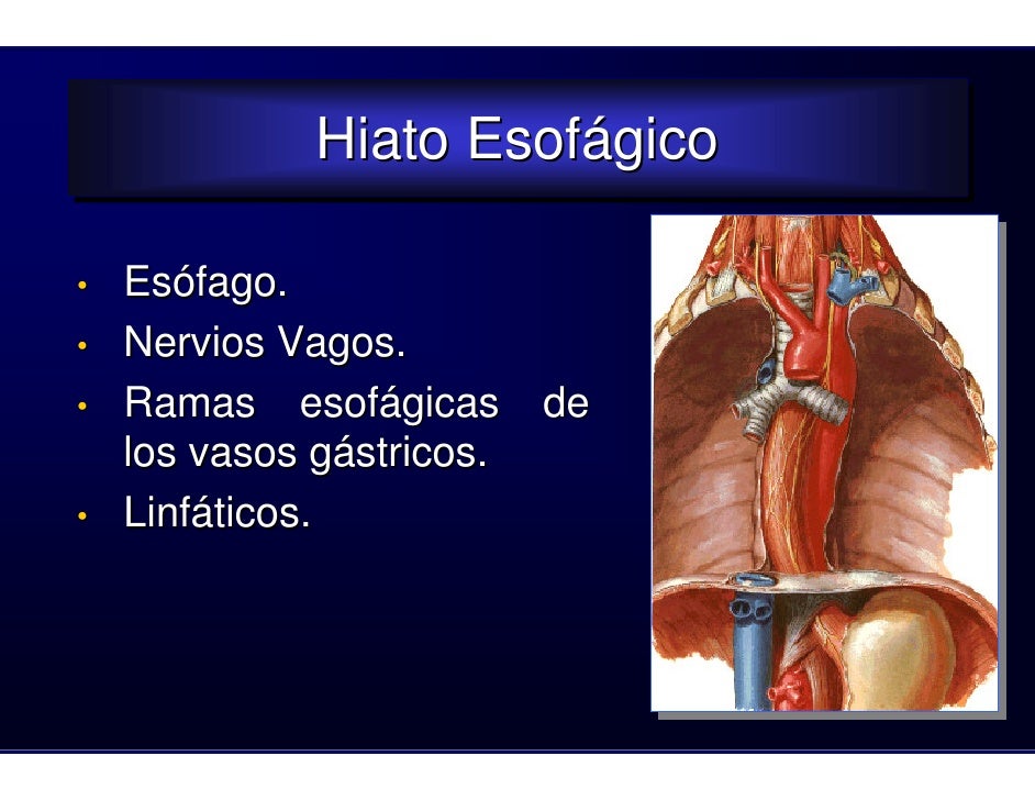 Clase esofago2008 Clase esofago2008