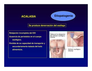 ACALASIA
Relajación incompleta del EEI
Ausencia de peristalsis en el cuerpo
esofágico.
Pérdida de su capacidad de transporte y
secundariamente éstasis del bolo
alimenticio.
Etiopatogenia
Se produce denervación del esófago
 