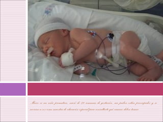Marco es un niño prematuro, nació de 29 semanas de gestación, sus padres están preocupados y se
acercan a vos como maestra de educación especial para consultarte qué camino deben tomar…
 