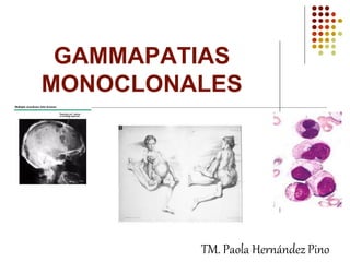 GAMMAPATIAS
MONOCLONALES
TM. Paola Hernández Pino
 