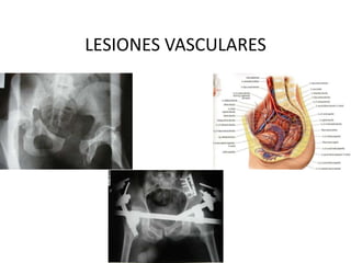 LESIONES VASCULARES,[object Object]
