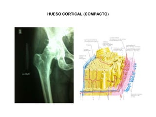 HUESO CORTICAL (COMPACTO),[object Object]
