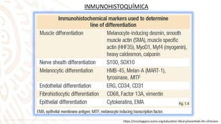 INMUNOHISTOQUÍMICA
https://oncologypro.esmo.org/education-library/essentials-for-clinicians
 