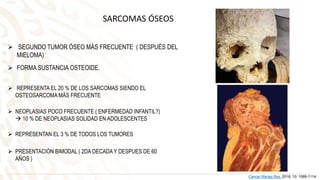 SARCOMAS ÓSEOS
 SEGUNDO TUMOR ÓSEO MÁS FRECUENTE ( DESPUÉS DEL
MIELOMA)
 FORMA SUSTANCIA OSTEOIDE.
Cancer Manag Res. 2018; 10: 1089-1114.
 REPRESENTA EL 20 % DE LOS SARCOMAS SIENDO EL
OSTEOSARCOMA MÁS FRECUENTE
 NEOPLASIAS POCO FRECUENTE ( ENFERMEDAD INFANTIL?)
 10 % DE NEOPLASIAS SOLIDAD EN ADOLESCENTES
 REPRESENTAN EL 3 % DE TODOS LOS TUMORES
 PRESENTACIÓN BIMODAL ( 2DA DECADA Y DESPUES DE 60
AÑOS )
 
