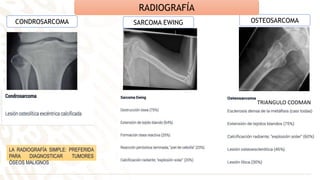 LA RADIOGRAFÍA SIMPLE: PREFERIDA
PARA DIAGNOSTICAR TUMORES
ÓSEOS MALIGNOS
CONDROSARCOMA SARCOMA EWING OSTEOSARCOMA
RADIOGRAFÍA
TRIANGULO CODMAN
 