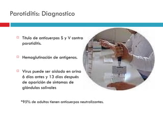 Parotiditis: Diagnostico


     Título de anticuerpos S y V contra
      parotiditis.

     Hemaglutinación de antígenos.

     Virus puede ser aislado en orina
      6 días antes y 13 días después
      de aparición de síntomas de
      glándulas salivales


      *95% de adultos tienen anticuerpos neutralizantes.
 