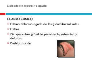 Sialoadenitis supurativa aguda



CUADRO CLINICO
 Edema doloroso agudo de las glándulas salivales

 Fiebre

 Piel que cubre glándula parótida hipertérmica y

  dolorosa.
 Deshidratación
 