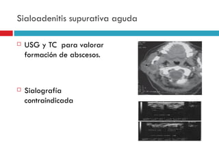 Sialoadenitis supurativa aguda

   USG y TC para valorar
    formación de abscesos.



   Sialografía
    contraindicada
 
