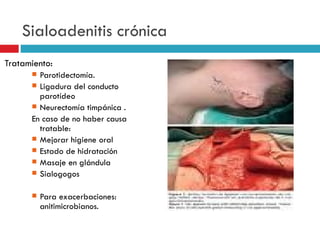 Sialoadenitis crónica
Tratamiento:
       Parotidectomía.
       Ligadura del conducto
        parotídeo
       Neurectomía timpánica .
      En caso de no haber causa
        tratable:
       Mejorar higiene oral
       Estado de hidratación
       Masaje en glándula
       Sialogogos


         Para exacerbaciones:
          anitimicrobianos.
 