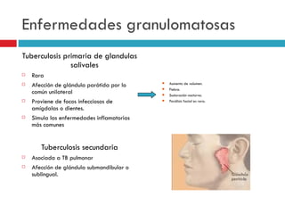 Enfermedades granulomatosas
Tuberculosis primaria de glandulas
               salivales
   Rara
                                                Aumento de volumen.
   Afección de glándula parótida por lo    
                                               Fiebre.
    común unilateral                           Sudoración nocturna.
   Proviene de focos infecciosos de           Parálisis facial es rara.
    amígdalas o dientes.
   Simula las enfermedades inflamatorias
    más comunes


       Tuberculosis secundaria
   Asociada a TB pulmonar
   Afección de glándula submandibular o
    sublingual.
 