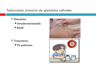 Tuberculosis primaria de glandulas salivales

      Dianóstico.
        Intradermoreacción.
        BAAF.




      Tratamiento.
        Tb pulmonar.
 