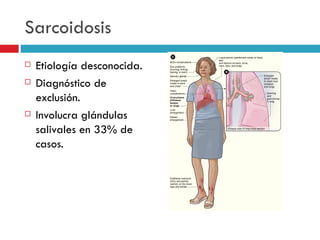 Sarcoidosis
   Etiología desconocida.
   Diagnóstico de
    exclusión.
   Involucra glándulas
    salivales en 33% de
    casos.
 