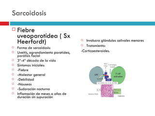 Sarcoidosis
   Fiebre
    uveoparotídea ( Sx
    Heerfordt)                            Involucra glándulas salivales menores
                                         Tratamiento:
   Forma de sarcoidosis:
   Uveítis, agrandamiento parotídeo,   -Corticoesteroides.
    parálisis facial
   3ª-4ª década de la vida
   Síntomas iniciales:
   -Fiebre
   -Malestar general
   -Debilidad
   -Nauseas
   -Sudoración nocturna
   Inflamación de meses o años de
    duración sin supuración
 