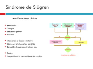 Síndrome de Sjögren

           Manifestaciones clínicas

   Xerostomía.
   Disfagia.
   Sequedad genital
   Piel seca

   Intolerancia a ácidos e irritantes
   Edema uni o bilateral de parótida
   Sensación de cuerpo extraño en ojo.

   Caries.
   Lengua fisurada con atrofia de las papilas.
 