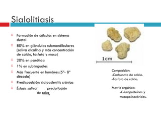 Sialolitiasis
   Formación de cálculos en sistema
    ductal
   80% en glándulas submandibulares
    (saliva alcalina y más concentración
    de calcio, fosfato y moco)
   20% en parótida
   1% en sublinguales
   Más frecuente en hombres.(5ª- 8ª        Composición:
    década)                                 -Carbonato de calcio.
                                            -Fosfato de calcio.
   Predisposición: sialoadenitis crónica
   Éstasis salival       precipitación     Matriz orgánica:
                   de sales                      -Glucoproteínas y
                                                 mucopolisacáridos.
 