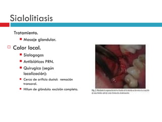 Sialolitiasis
    Tratamiento.
         Masaje glandular.
   Calor local.
         Sialogogos
         Antibióticos PRN.
         Quirugico (según
          localización):
         Cerca de orificio ductal: remoción
          transoral.
         Hilium de glándula: excisión completa.
 