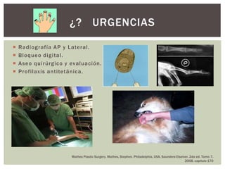 ¿? URGENCIAS

   Radiografía AP y Lateral.
   Bloqueo digital.
   Aseo quirúrgico y evaluación.
   Profilaxis antitetánica.




                      Mathes Plastic Surgery. Mathes, Stephen. Philadelphia, USA. Saunders Elseiver. 2da ed. Tomo 7.
                                                                                                 2008. capitulo 170
 