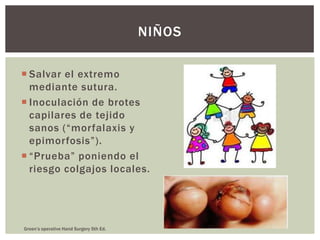 NIÑOS

 Salvar el extremo
  mediante sutura.
 Inoculación de brotes
  capilares de tejido
  sanos (“morfalaxis y
  epimorfosis”).
 “Prueba” poniendo el
  riesgo colgajos locales.




Green’s operative Hand Surgery 5th Ed.
 