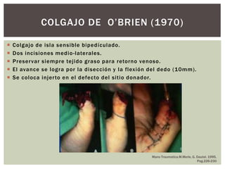 COLGAJO DE O’BRIEN (1970)

   Colgajo de isla sensible bipedículado.
   Dos incisiones medio -laterales.
   Preser var siempre tejido graso para retorno venoso.
   El avance se logra por la disección y la flexión del dedo (10mm).
   Se coloca injer to en el defecto del sitio donador.




                                                     Mano Traumatica.M.Merle, G. Dautel. 1995,
                                                                                 Pag.226-230
 